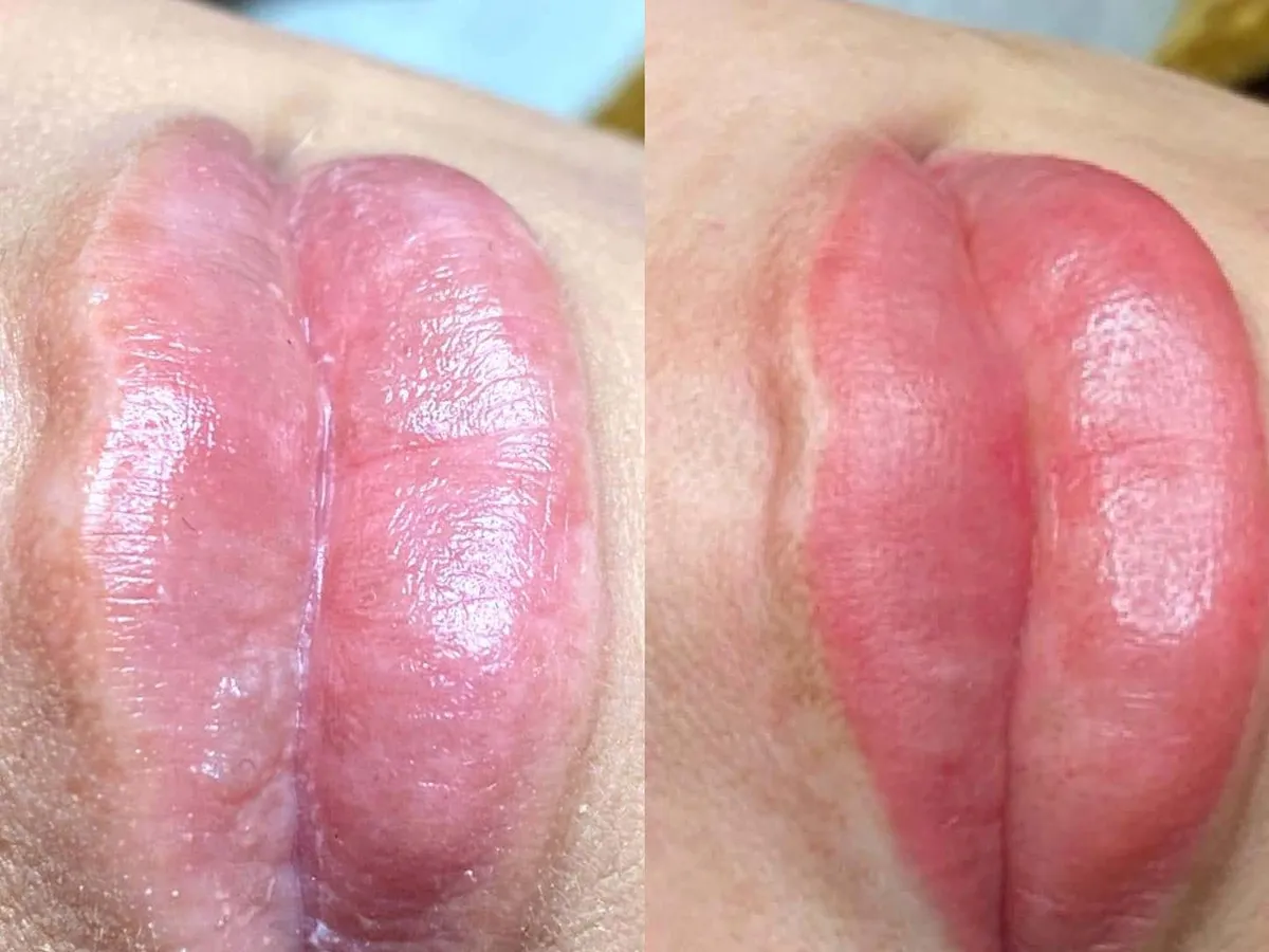 Healed lip blush, before and after